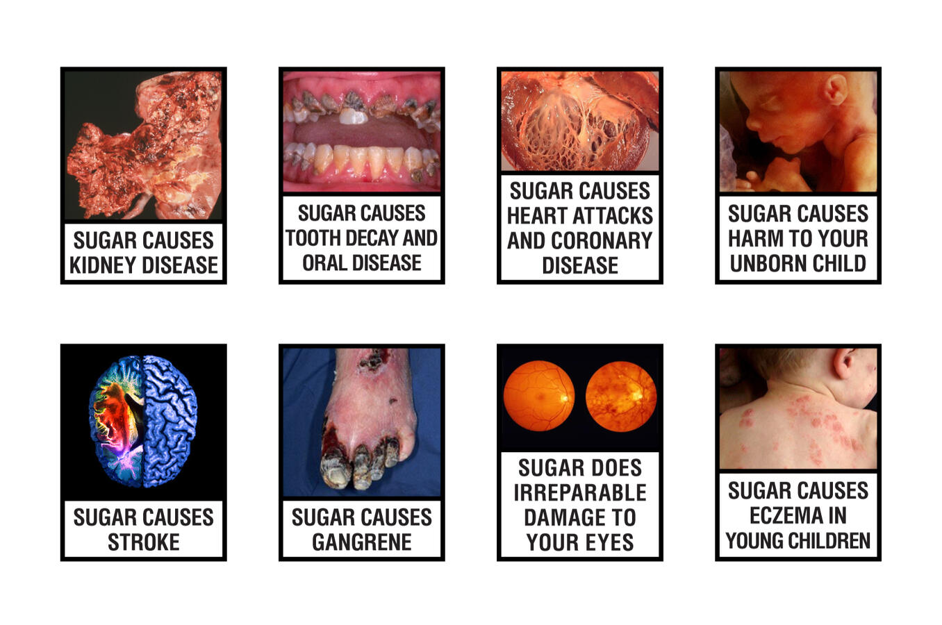 Cigarette Box Warnings (secondary activation): "1 Every 6 Seconds" - Diabetes Association of Sri Lanka, World Diabetes Day 2014